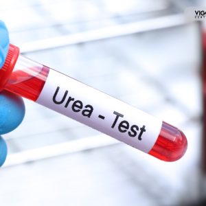 Mocznik – jak pracują Twoje nerki