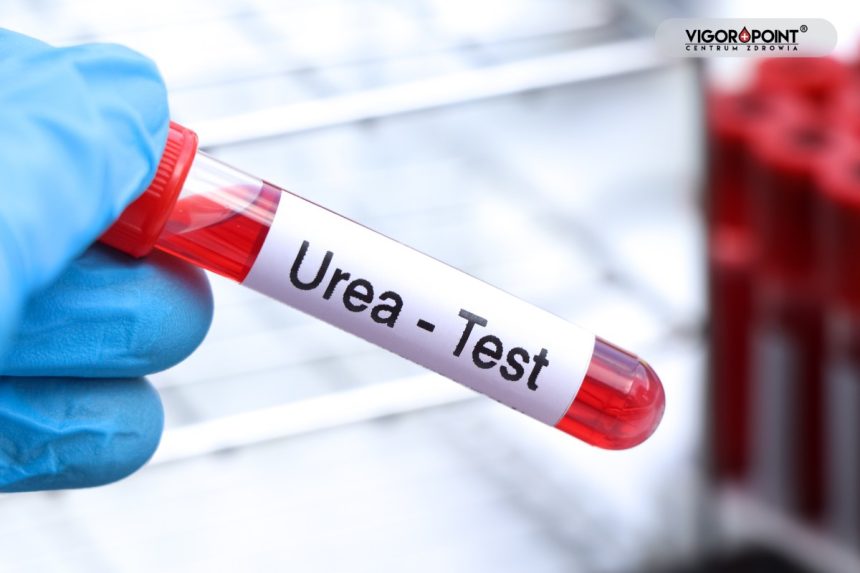 Mocznik – jak pracują Twoje nerki