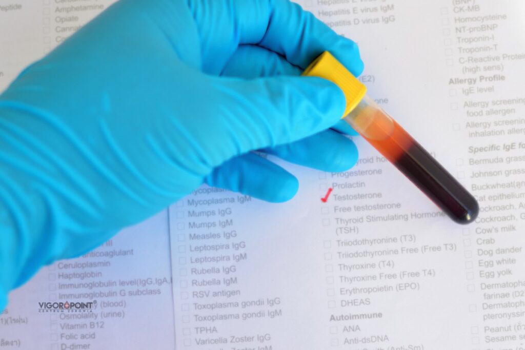 Badanie testosteronu - skutki uboczne testosteronu