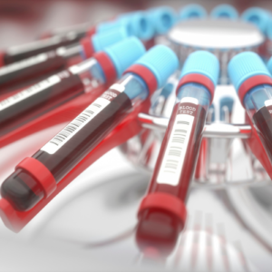 Diagnostyka laboratoryjna – korzystaj nie tylko jak zaczynasz się źle czuć