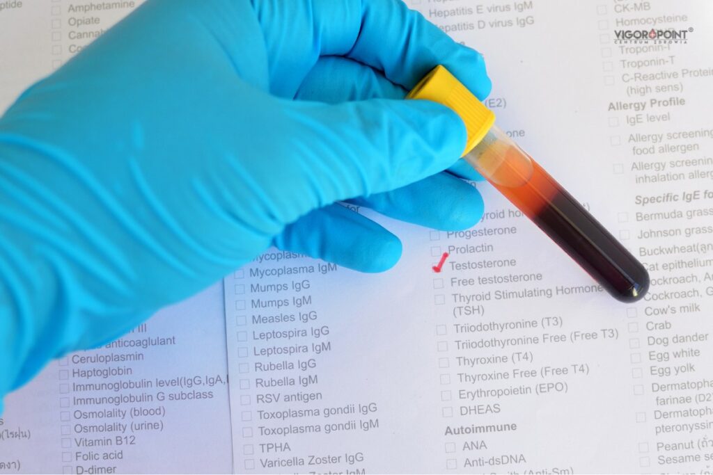 Domowy test na testosteron - dostarczenie próbki