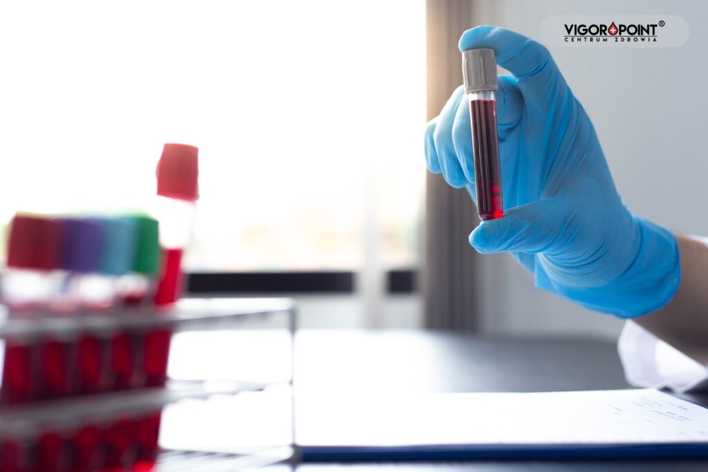 Fiolka z krwią w dłoni laboranta. Testosteron na siłowni - jakie badania  wykonywać