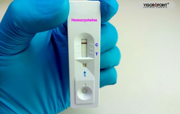 Homocysteina – lepsza niż cholesterol?