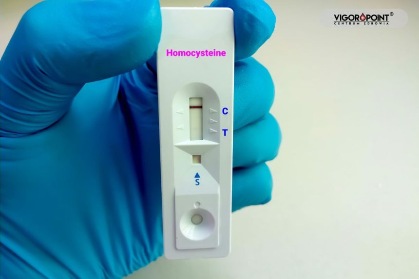 Homocysteina – lepsza niż cholesterol? Homocysteina – lepsza niż cholesterol?