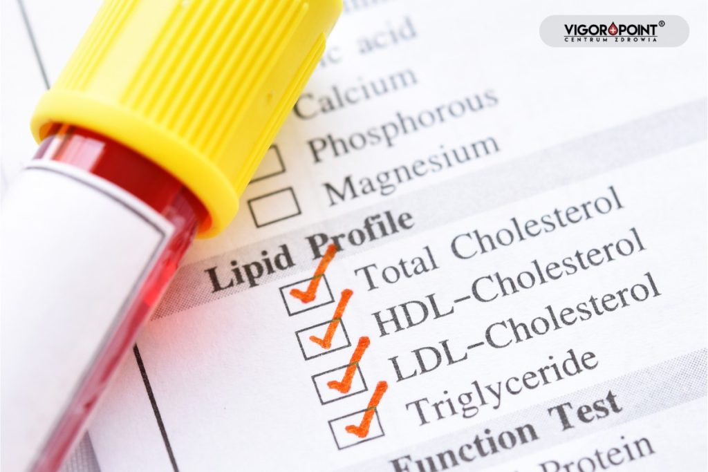 Lipid test wyniki. Badania po cyklu sterydowym – co sprawdzić obowiązkowo