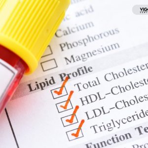 Badania po cyklu sterydowym – co sprawdzić obowiązkowo Badania po cyklu sterydowym – co sprawdzić obowiązkowo