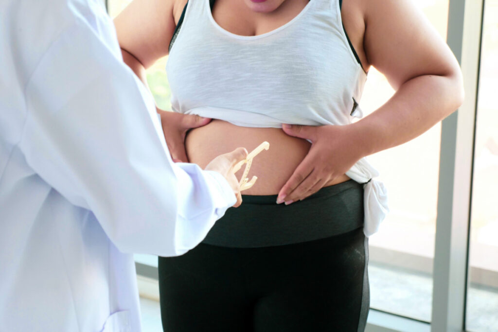 Pomiar tkanki tłuszczowej i otyłej kobiety. Zachowawcze leczenie otyłości — formy terapii