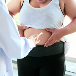 Zachowawcze leczenie otyłości — dostępne formy terapii