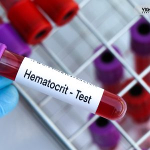 Hematokryt – dlaczego krew gęstnieje na testosteronie Hematokryt – dlaczego krew gęstnieje na testosteronie