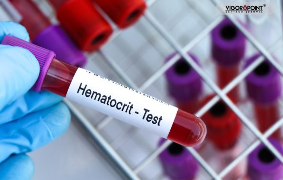 Hematokryt – dlaczego krew gęstnieje na testosteronie Hematokryt – dlaczego krew gęstnieje na testosteronie