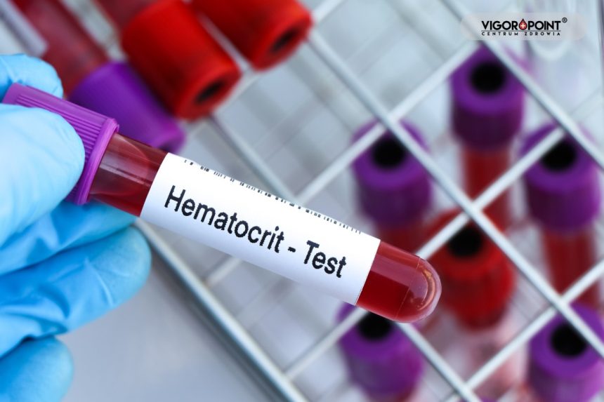 Hematokryt – dlaczego krew gęstnieje na testosteronie