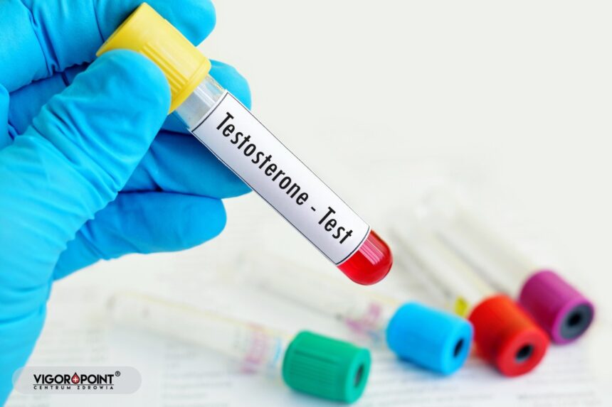 Diagnostyka testosteronu – kiedy warto się przebadać i co oznaczają wyniki