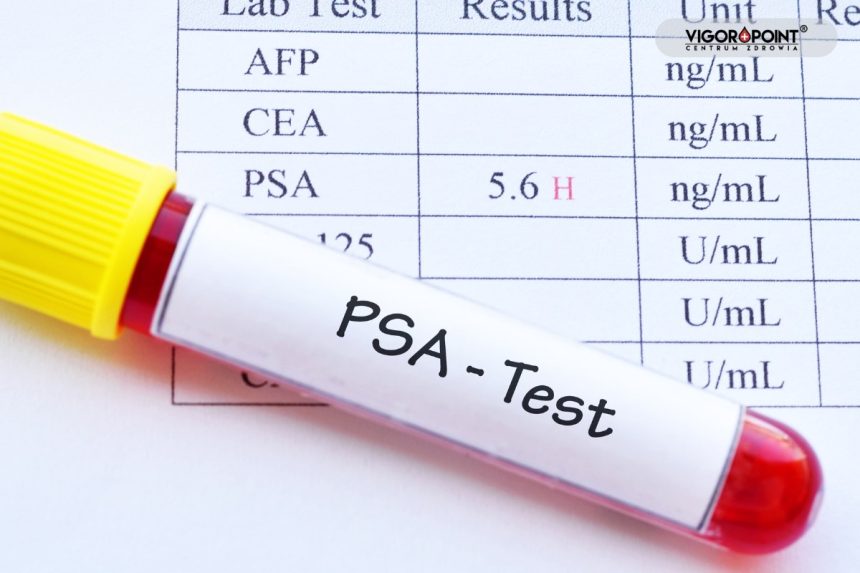 Badanie PSA – męska profilaktyka po 45. roku życia