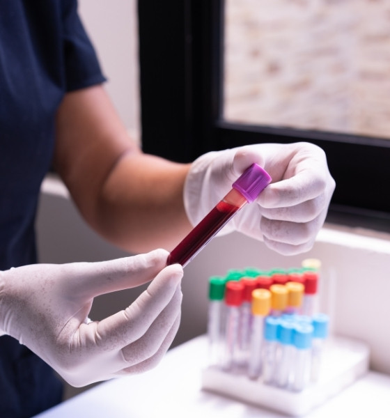 Laborantka z próbkami krwi do badania