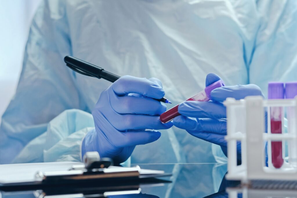 Laborantka oznacza probówki z krwią. badania diagnostyczne przed zmianą diety